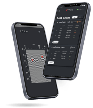 Live Dig Radar LDR Insights