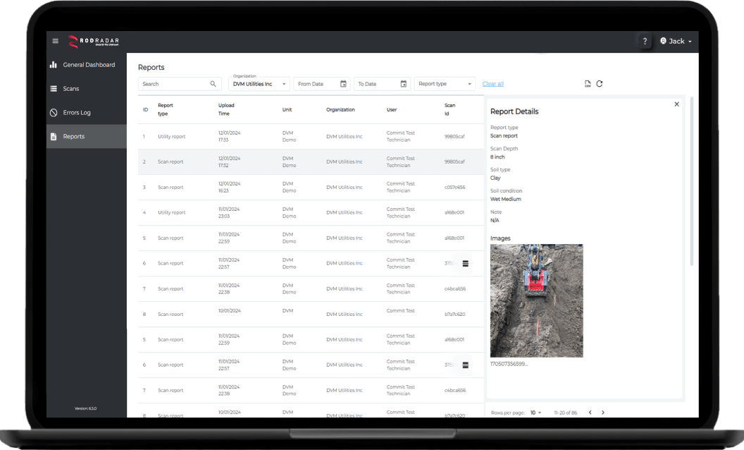 Live Dig Radar LDR Insights